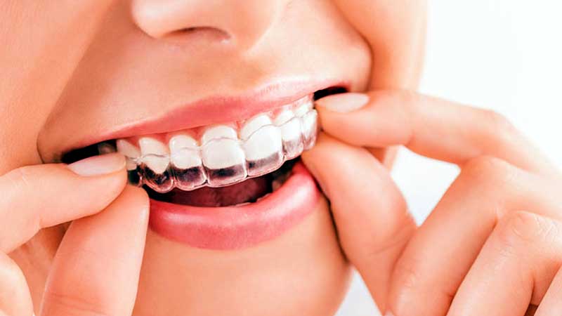 Cosmetic Dentistry In porur