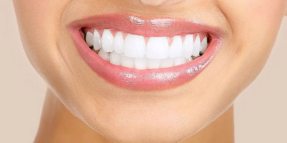 Teeth Bleaching In Iyyappanthangal