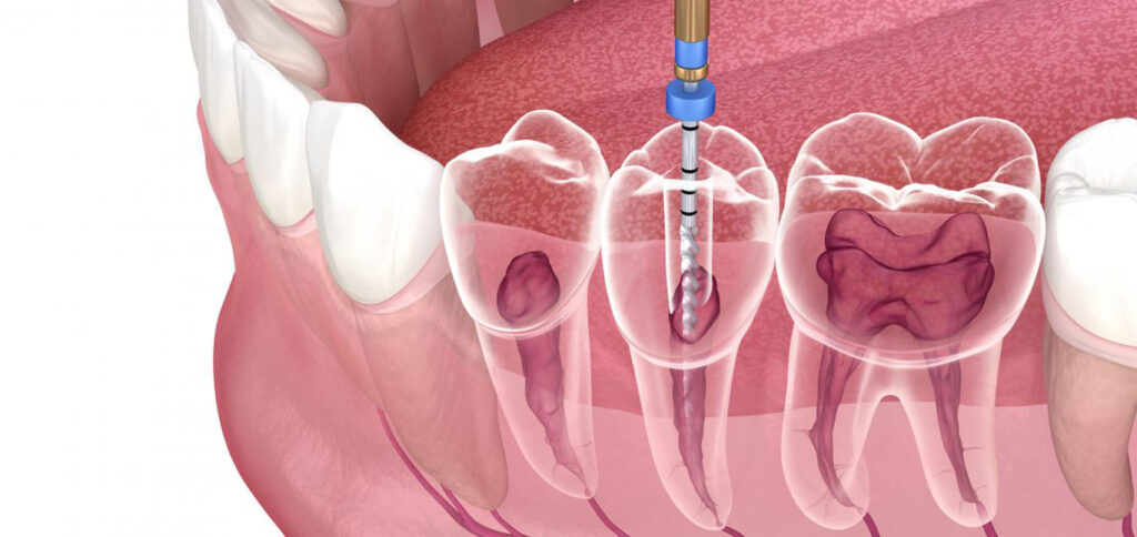 Comprehensive Dental Treatment In porur